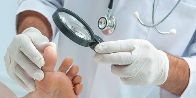 Medicul examinează piciorul unui pacient cu un vârf cu o lupă