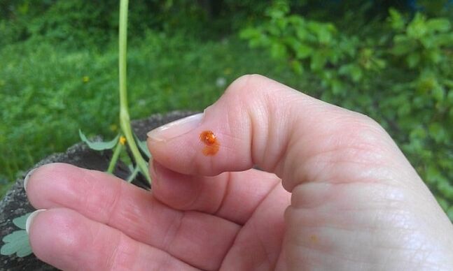 Celandine aplicată pe deget