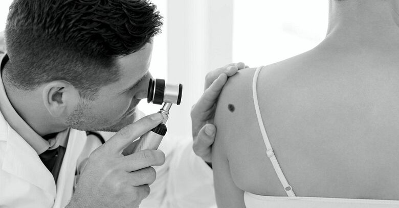 un specialist diagnostichează tipul de neg